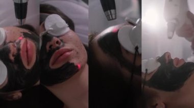 Genç ve güzel bir kızın yüzünün karbonu soyuluyor. Cilt bakımı kozmetolojisi. Lazer terapisi ve cilt tedavisi. Video kolajı.