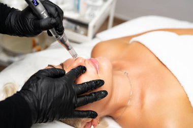 Mikroedle RF kaldırma prosedürü. Bir kozmetikçi bir kadına yüz gençleştirme ameliyatı yapar. Donanım kozmetolojisi.