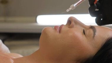 Kadın çenesi yakınındaki şırınga, çene şekli düzeltmesi için doldurulmuş güzellik iğneleri..