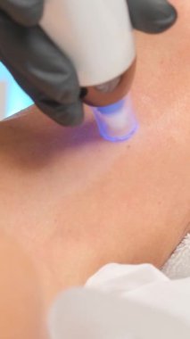 Güzellik uzmanının dermapen 'i ile mikronedling yaparken güzel yaşlı bir kadının yakın plan portresi. Dikey video.