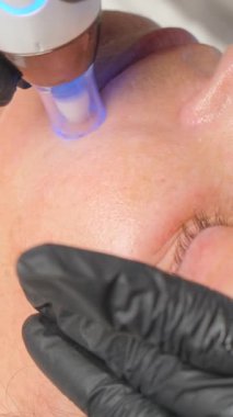 Güzellik uzmanının dermapen 'i ile mikronedling yaparken güzel yaşlı bir kadının yakın plan portresi. Dikey video.