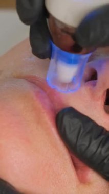 Güzellik uzmanının dermapen 'i ile mikronedling yaparken güzel yaşlı bir kadının yakın plan portresi. Dikey video.