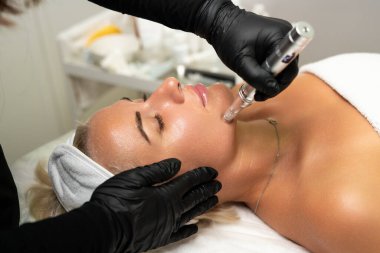 Mikroedle RF kaldırma prosedürü. Bir kozmetikçi bir kadına yüz gençleştirme ameliyatı yapar. Donanım kozmetolojisi.