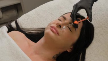 Kadın çenesi yakınındaki şırınga, çene şekli düzeltmesi için doldurulmuş güzellik iğneleri..