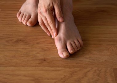 Hallux valgus şişliği ve ayak tırnağı mantarı belirtileri olan bir kadının ayağını yakından çek. Eli nazikçe baş parmağına dokunuyor. Bu da ayak sorunlarını ve tıbbi bakım ihtiyacını gösteriyor..