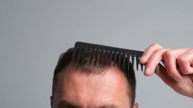 Kelliği olan bir adam saçını tarar. Saç dökülmesi sorunu olan bir adam. Gri arka planda alopesisi olan genç bir adamın yakın çekimi..