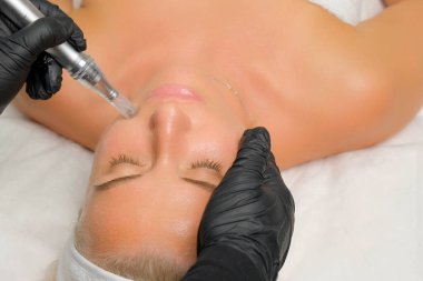 Mikroedle RF kaldırma prosedürü. Bir kozmetikçi bir kadına yüz gençleştirme ameliyatı yapar. Donanım kozmetolojisi.