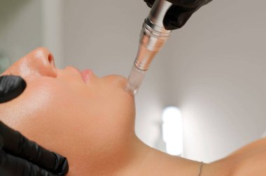 Mikroedle RF kaldırma prosedürü. Bir kozmetikçi bir kadına yüz gençleştirme ameliyatı yapar. Donanım kozmetolojisi.