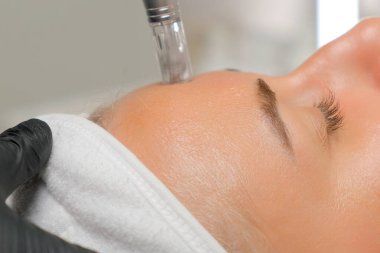 Mikroedle RF kaldırma prosedürü. Bir kozmetikçi bir kadına yüz gençleştirme ameliyatı yapar. Donanım kozmetolojisi.