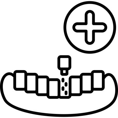 Diş implantı prosedürü artı işareti ile