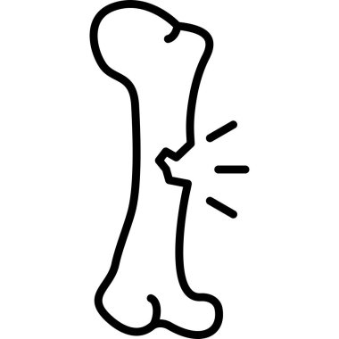 Kırık kemik ve çatlak çizimi.