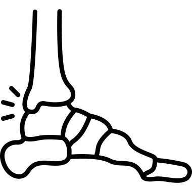 Yaralı bilek ekleminin çizgi çizimi