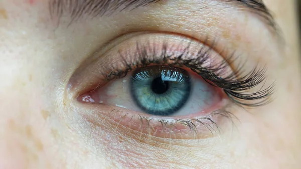 Nahaufnahme Eines Blauen Auges Gesicht Eines Schönen Mädchens Mit Sommersprossen — Stockfoto