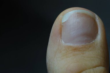 A detailed close up of a human thumb, showcasing the texture of skin and nail. A detailed close up of a human thumb, showcasing the texture of skin and nail. This image is perfect for concepts related clipart