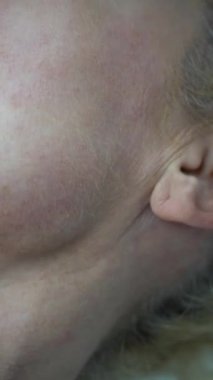 Yaşlanan Cilt, Olgun Yüz, Yaşlanma Karşıtı Tedavi