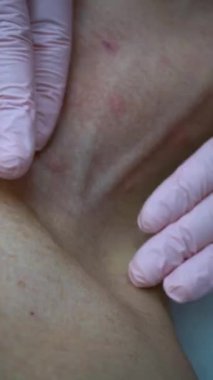 Yaşlanan Cilt, Olgun Yüz, Yaşlanma Karşıtı Tedavi, Boynunda Yaşlanan Cilt