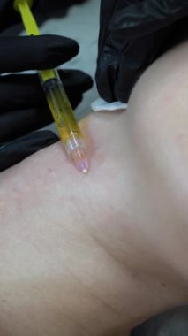 Kozmetik uzmanı boyun enjeksiyonu, boyun enjeksiyonu, estetik ameliyat