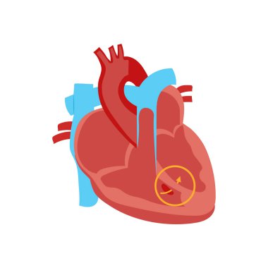 Vektörde doğuştan kalp yetmezliği ikonu. Logotype