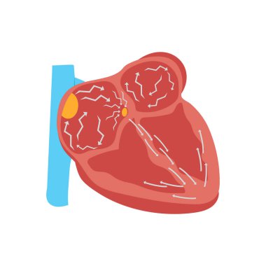 Atrial Fibrilasyon ikonu vektörde. Logotype