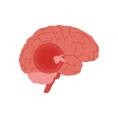 Epilepsi Düz Vektör Resimleri İzole Edildi