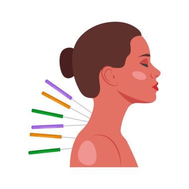 Boyun Akupunktur Vektör İllüstrasyonu - izole