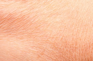 Kuru insan derisinin makro dokusu, kurumuş üst deri kaplama görüntüsü, buruşmuş vücut derisi kaba detay yüzeyi, kadın sağlığı ve dermatoloji arka plan tasarımı için anatomi kavramı
