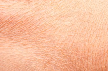 Kuru insan derisinin makro dokusu, kurumuş üst deri kaplama görüntüsü, buruşmuş vücut derisi kaba detay yüzeyi, kadın sağlığı ve dermatoloji arka plan tasarımı için anatomi kavramı