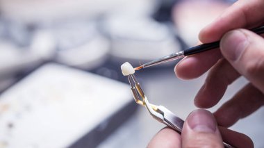Diş implantı, protez ve kaplama üretimi için profesyonel bir laboratuarda yakın plan, bir usta diş implantı, protez ve kaplama üretiminde diş ürünlerinin özgün ve gölgelerini modellemek için bir fırça kullanır.
