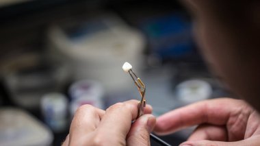 Bu görüntüde, yetenekli bir teknisyen dişçi tacını cımbızla dikkatlice tutuyor. Odaklanma, modern bir laboratuvar ortamında dişçi protezi yapımında uygulanan karmaşık süreci yansıtıyor..