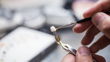 Becerikli bir diş teknisyeni titizlikle bir dişçi restorasyonu üzerinde çalışıyor. Resim, özel araçlar kullanılarak bir diş kaplamasına ayrıntıların uygulanma sürecini yakalar.
