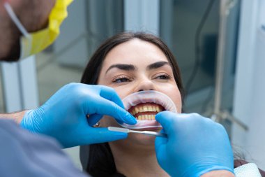 Bu görüntüde, bir diş hekimi hastasının dişlerini dikkatlice incelerken, dişçi de dişçi koltuğunda oturur ve diş işlemleri sırasında alınan aletleri ve bakımı gösterir..