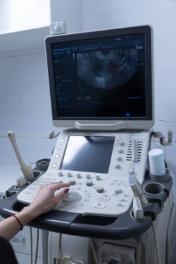 Modern bir ultrason makinesi tıbbi bir ortamda tasvir edilir. Ekran bir görüntüleme sürecinin detaylı bir görünümünü gösterirken, bir profesyonel doğru tanılama için denetimleri ayarlar.