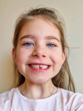 Neşeli bir çocuk yakın zamanda kaybolan bir dişin boşluğunu gösteriyor, parlak bir gülümsemeyle.