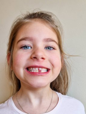 Neşeli bir çocuk yakın zamanda kaybolan bir dişin boşluğunu gösteriyor, parlak bir gülümsemeyle.