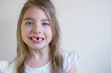 Beyaz bir elbise içinde gülümseyen, bebek dişleri eksik neşeli bir genç kız.