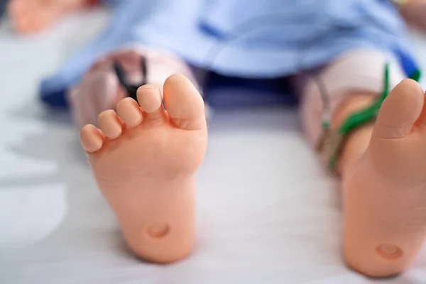 Detailní Záběr Nohy Pacienta Figuríny Ležící Lůžku Pacienta — Stock fotografie