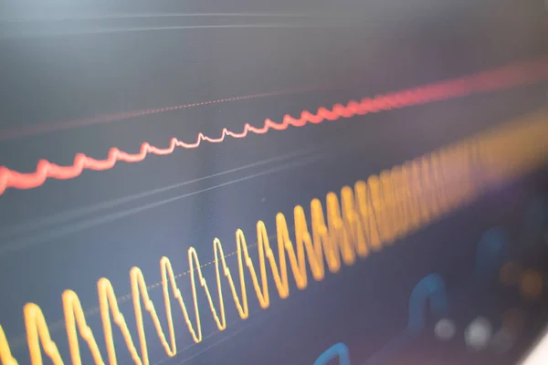 Cardiofrequenzimetro Monitor Pressione Arteriosa Ospedaliero — Foto Stock