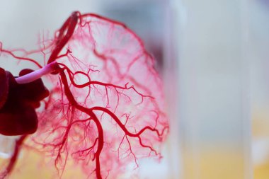 Kardiyovasküler sistem arka planı, kan damarlarının görüntülerini göstermek için kullanılan tıbbi bir prosedürdür..