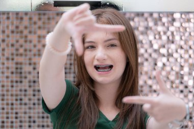 Dişlerinde diş teli olan genç bir kadın parmaklarıyla çerçeve yapıyor.