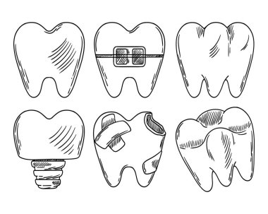 Bir dizi vektör dişi. Protezler için diş çizimi, diş teli, azı dişi, dişleri için diş. Diş tedavisi, dişçilik, ortodonti. Vektör illüstrasyonu