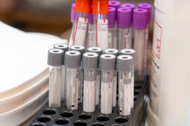 Kan bağışında kan örneği tüpleri.