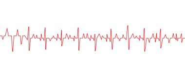 Sağlıklı Kalp Ritminin Elektrokardiyogramı