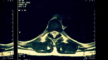 Yaralı bir insanın tomografi taramaları. Kare kare. Kusursuz döngü.