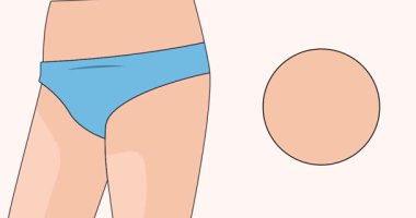 Animasyon açıklaması dermatit hastalığı