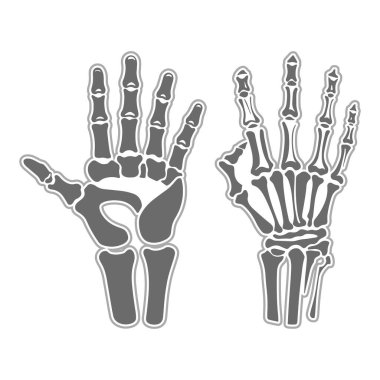 iskelet eli siyah renkte.