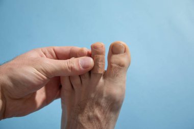 İnsan bacağında yapıştırıcı bandaj var..