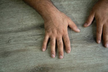 Masada beyaz insan eli var.. 