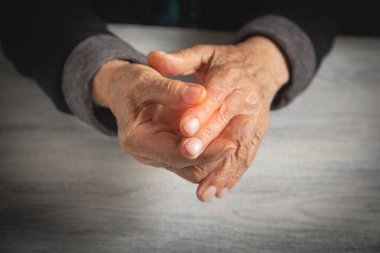 Kafkasyalı yaşlı kadın parmak ağrısı çekiyor..