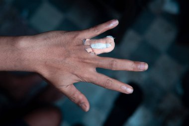 Bandaja sarılı kesik bir parmak ile insan elinin yakın çekimi. Travma, ağrı ve acil servise odaklanarak ciddi bir yaralanmanın sonuçlarını yakalıyor. Tıbbi veya güvenlik içeriği için uygun.