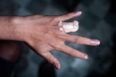 Bandaja sarılı kesik bir parmak ile insan elinin yakın çekimi. Travma, ağrı ve acil servise odaklanarak ciddi bir yaralanmanın sonuçlarını yakalıyor. Tıbbi veya güvenlik içeriği için uygun.